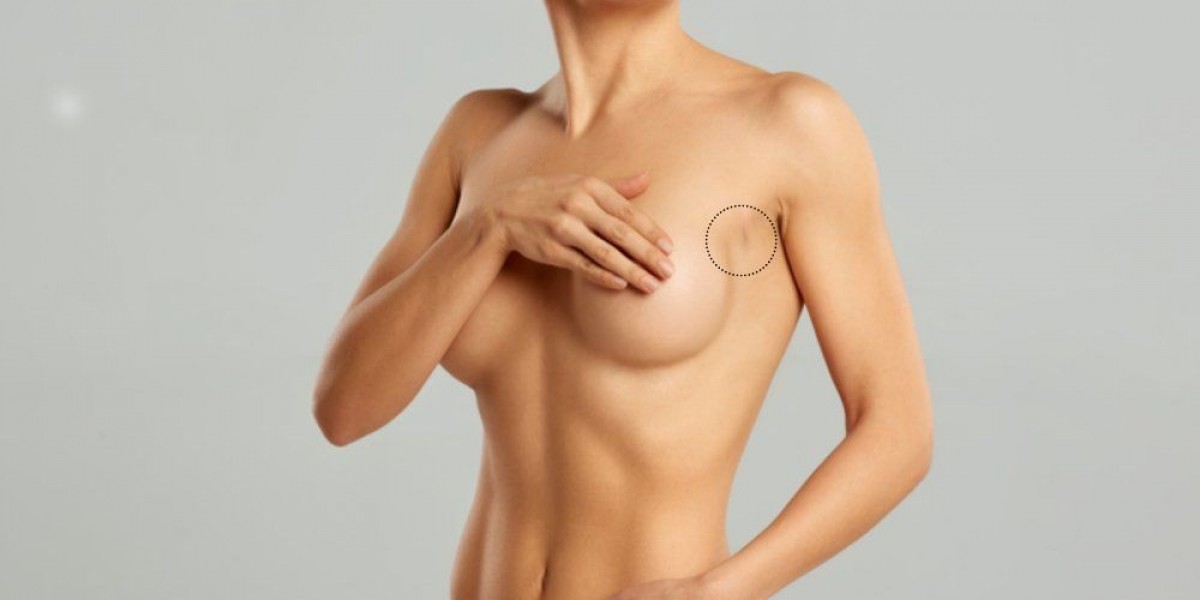 From Dream to Reality: Planning Your Breast Augmentation