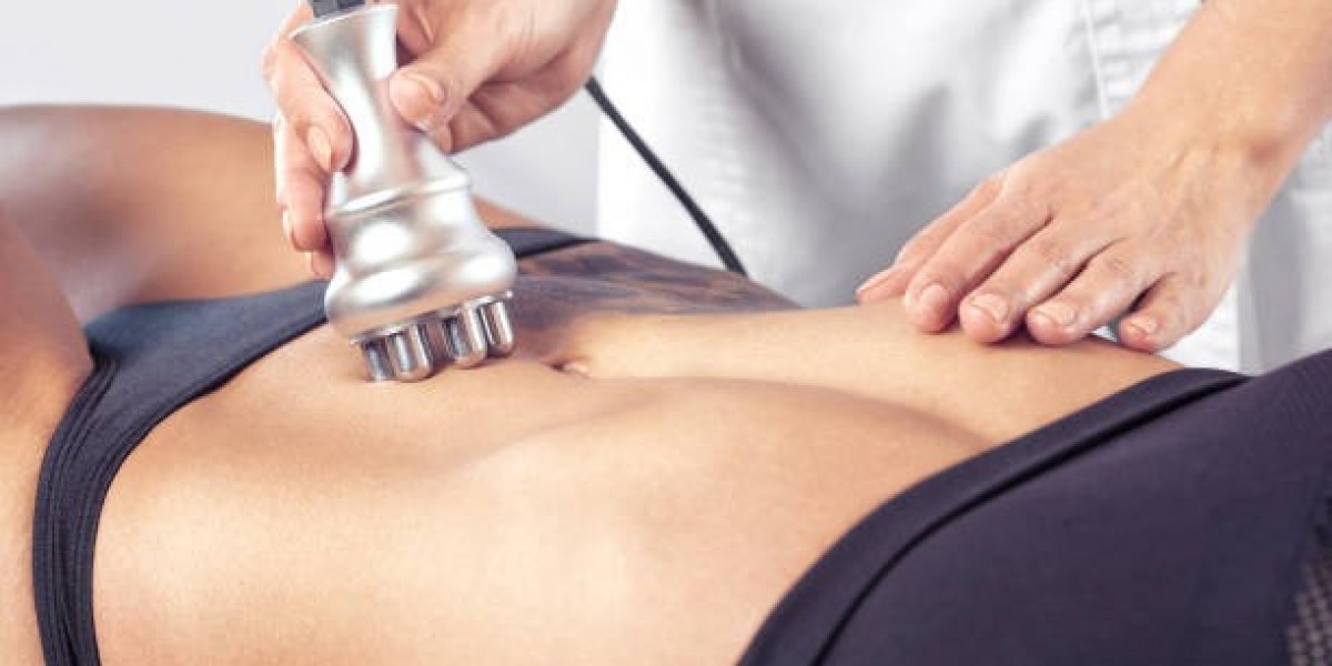 CoolSculpting Fat Freezing: The Non-Invasive Fat Removal Solution