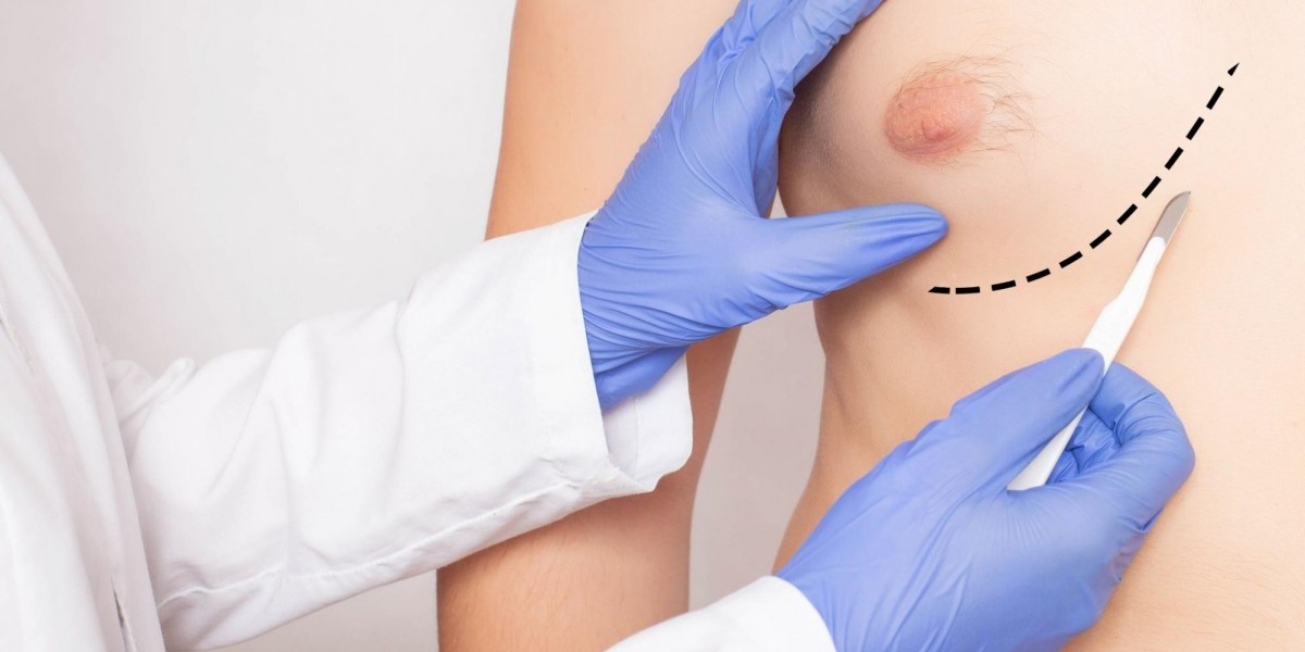 Can Gynecomastia Surgery Improve Posture?