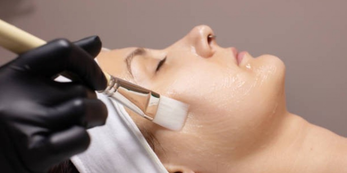 How Chemical Peels in Riyadh Target Fine Lines and Wrinkles
